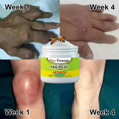 Bee Venom Joint and Bone Therapy Cream (Buy 1 Get 1 Free)