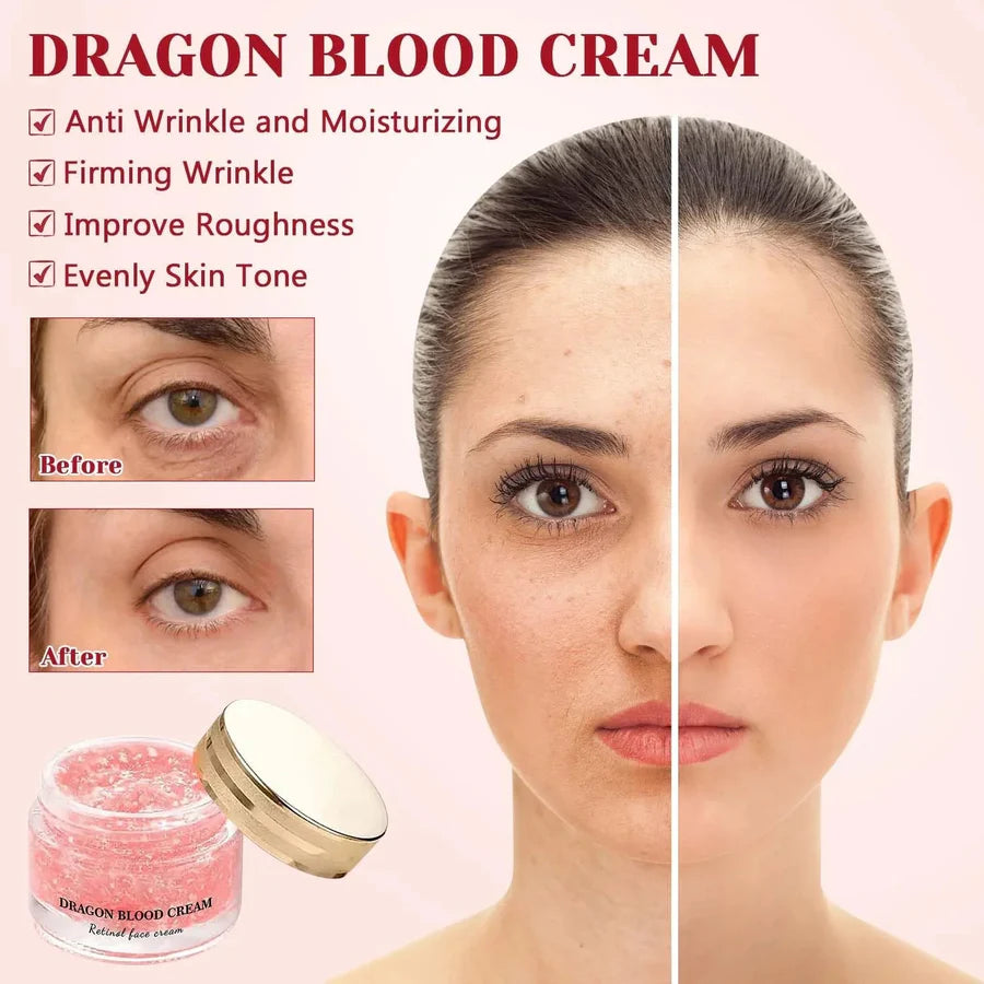 DRAGON BLOOD CREAM (Buy 1 Get 1 Free)